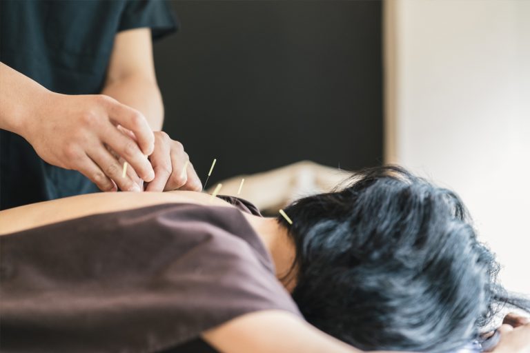 acupuncture winnipeg